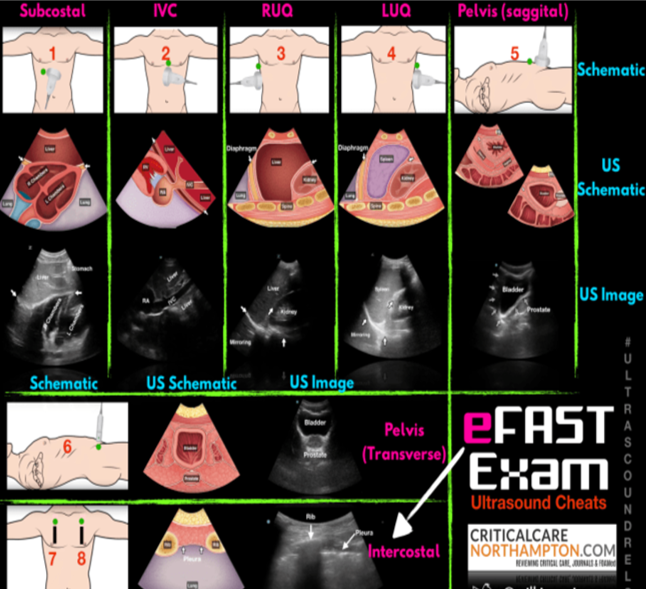 Ultrasound Content